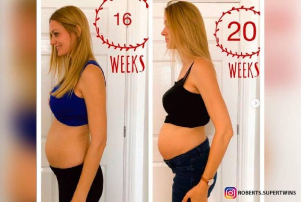 De acuerdo con los médicos los bebés tienen tres semanas de diferencia. 'Se dieron cuenta de que el bebé estaba creciendo a un ritmo constante de tres semanas menos que el primero, y fue entonces cuando me dijeron que creían que era un embarazo de superfetación', indicó.<br/>