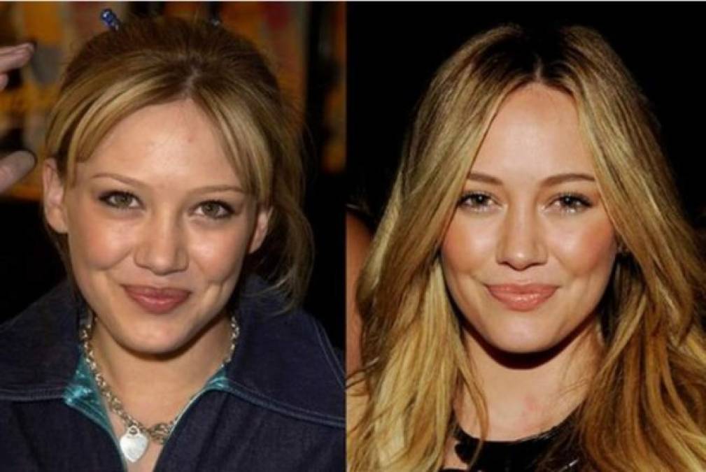 Hilary Duff no ha cambiado mucho con el tiempo, sin embargo, la cirugía en su nariz es evidente.