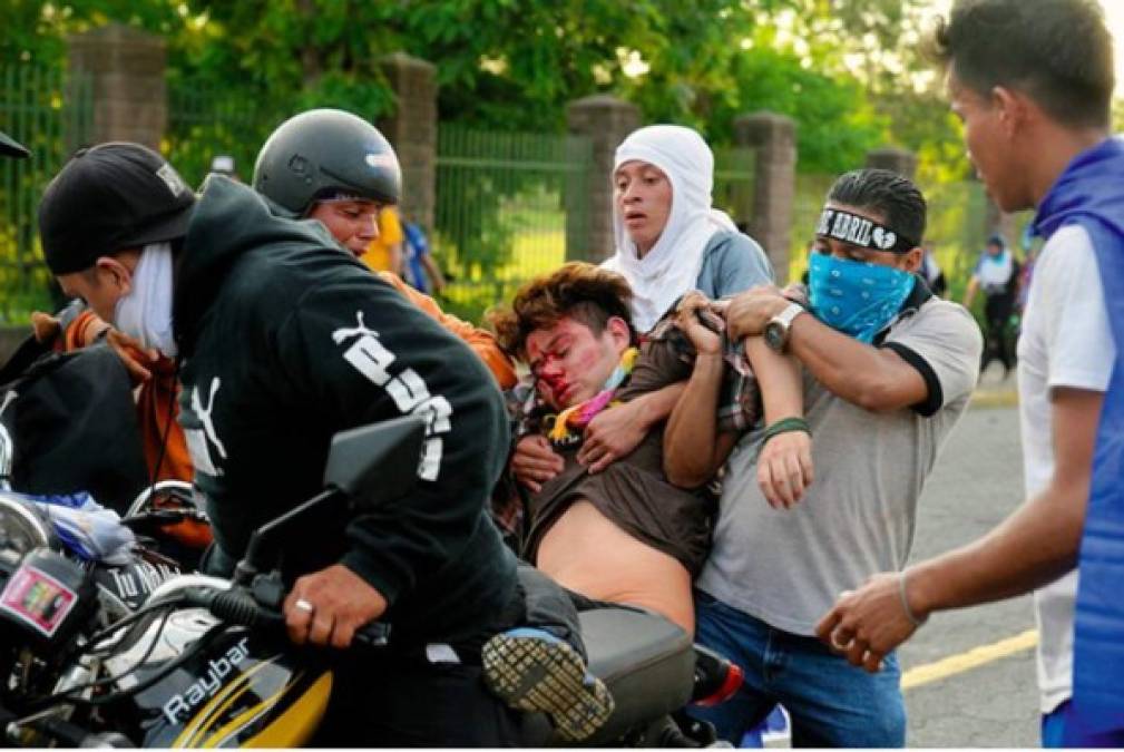Las víctimas se registraron en las ciudades de Managua, Estelí y Masaya, aunque también hubo incidentes en León./ Foto: La Prensa de Nicaragua.