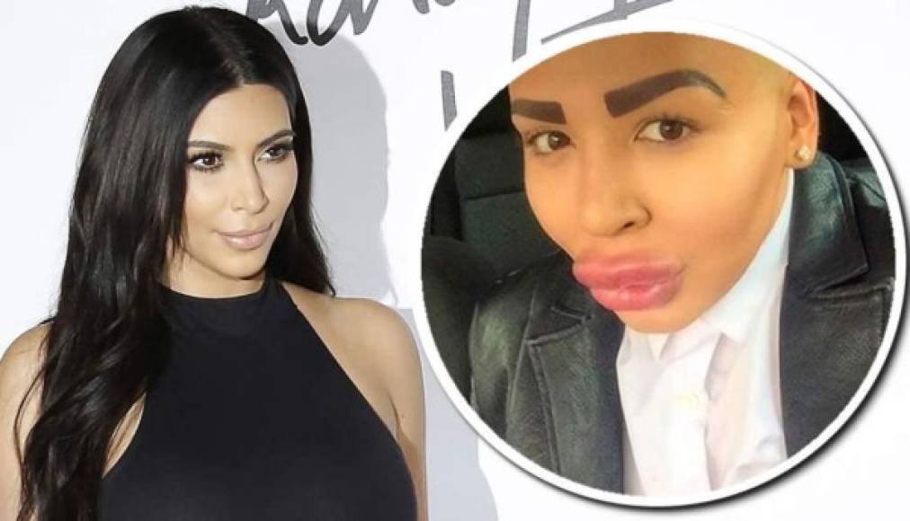 Este joven llamado Jordan James Parker se ha gastado aproximadamente 120.000 euros para parecerse a la famosa Kim Kardashian y confesó haber perdido movilidad en su rostro.