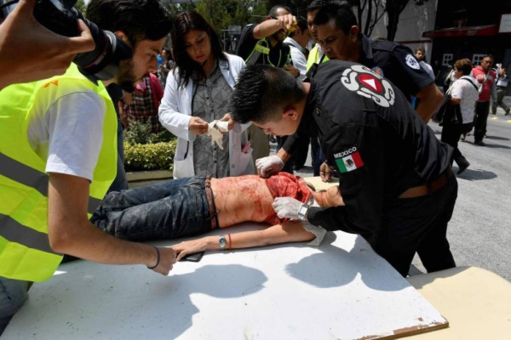 A woman is assisted after being injured during a quake in Mexico City on September 19, 2017.<br/>A powerful earthquake shook Mexico City on Tuesday, causing panic among the megalopolis' 20 million inhabitants on the 32nd anniversary of a devastating 1985 quake. The US Geological Survey put the quake's magnitude at 7.1 while Mexico's Seismological Institute said it measured 6.8 on its scale. The institute said the quake's epicenter was seven kilometers west of Chiautla de Tapia, in the neighboring state of Puebla.<br/> / AFP PHOTO / Omar TORRES