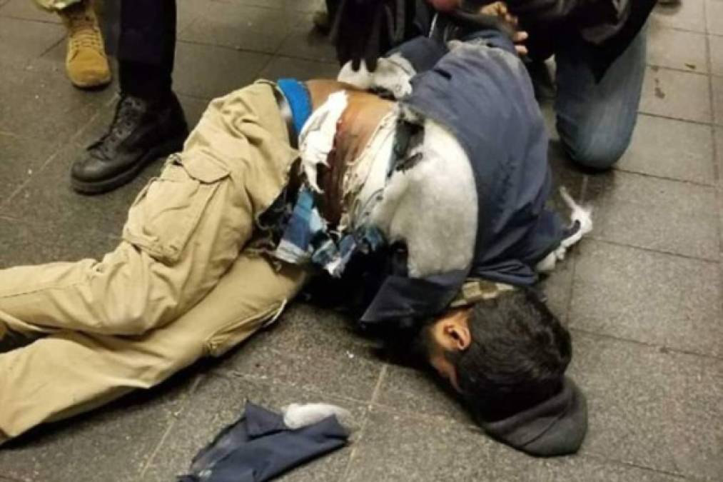 El sospechoso, identificado como Akayed Ullah, de 27 años, sufrió heridas y quemaduras, dijeron las autoridades. Fue detenido y trasladado al hospital Bellevue.