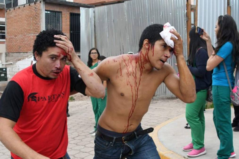 Uno de los estudiantes en protesta, con el rostro cubierto, dijo a periodistas que 'muchos compañeros están sangrando, otros con las piernas rotas por los golpes que han recibido con cadenas'.<br/>