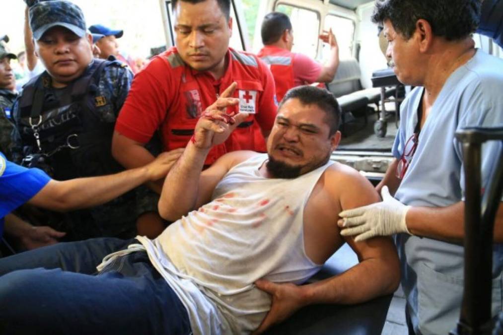 Un total de 33 reclusos heridos fueron atendidos en el hospital Mario Rivas de San Pedro Sula.