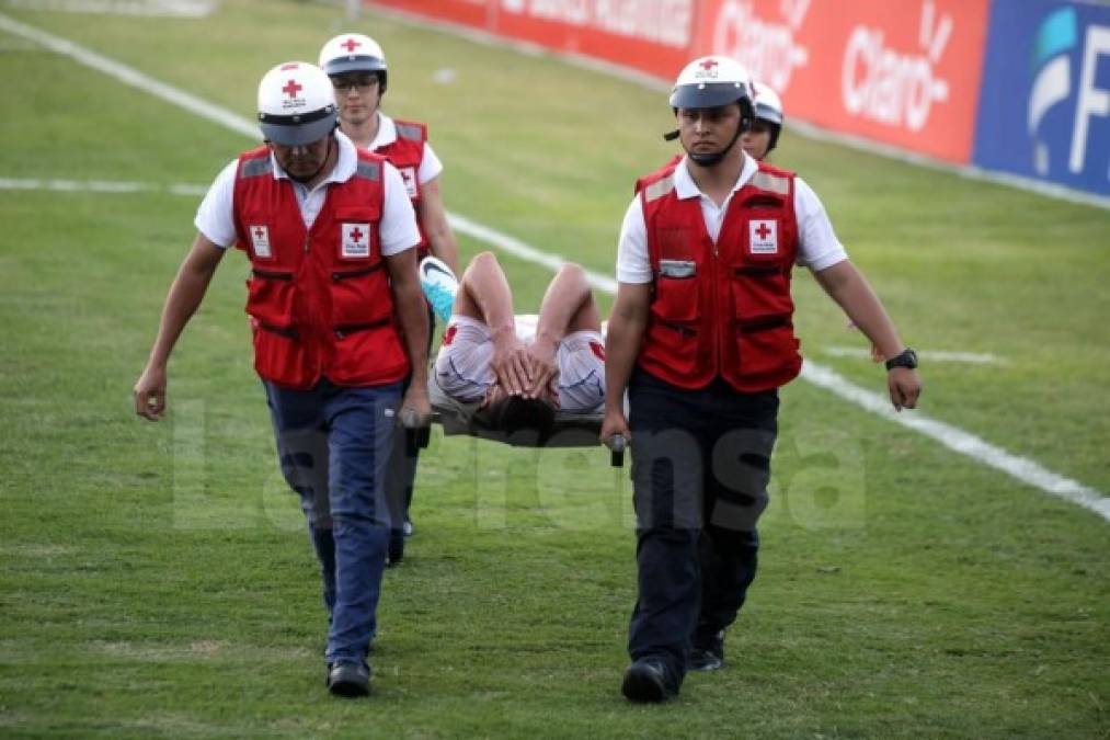 El defensa del Olimpia, Jonathan Paz, se lesionó y dejó el campo en camilla.