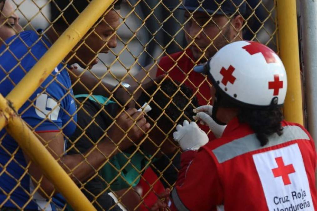 Una médico de la Cruz Roja atiende a un aficionado.