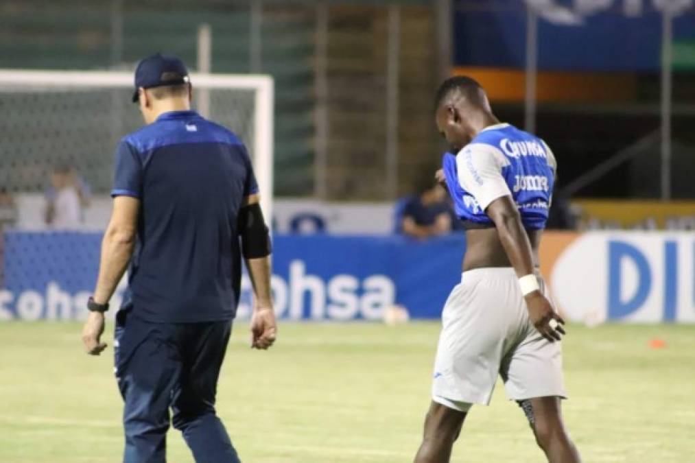 Román Rubilio Castillo iba de titular, pero se lesionó en el calentamiento y se cayó del partido. El delantero se retiró cabizbajo al camerino. Foto Twitter @TelevicentroHn