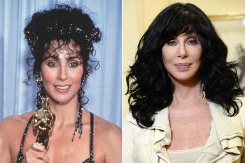 Cher es una fanática de las cirugías plásticas.