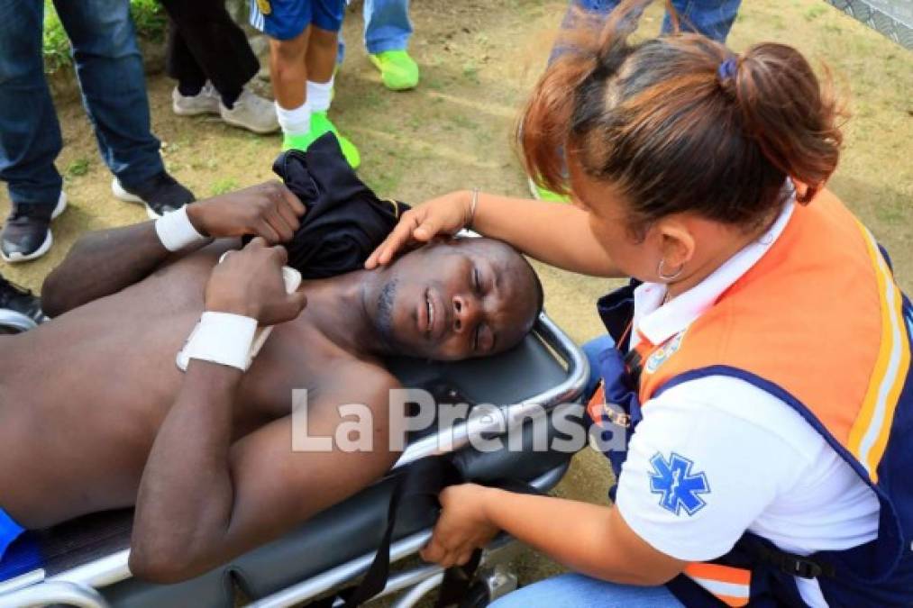 Rubilio Castillo fue asistido en la ambulancia por el fuerte dolor en su rostro.