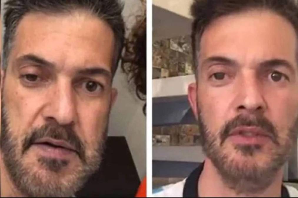 Solar también reveló que hace un tiempo sufrió una parálisis facial, lo que provocó el daño en su párpado: “Hace como un año tuve una parálisis en la cara y apenas está terminando de recuperar, pero eso fue todo”