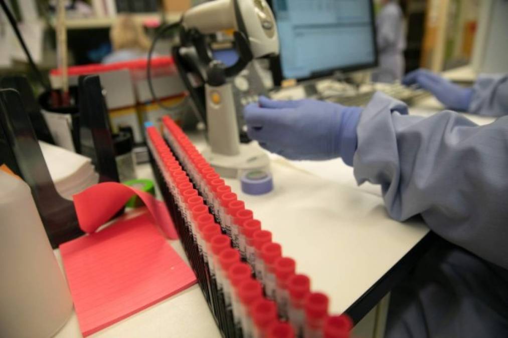 La vacuna se denomina RNA-1273 y ha sido desarrollada por científicos del Instituto Nacional de Alergia y Enfermedades Infecciosas (NIAID) y de la compañía de biotecnología Moderna, informaron los Institutos Nacionales de Salud (NIH, en inglés), que destacaron que el proyecto de inoculación frente al coronavirus ha tenido resultados prometedores en modelos animales.