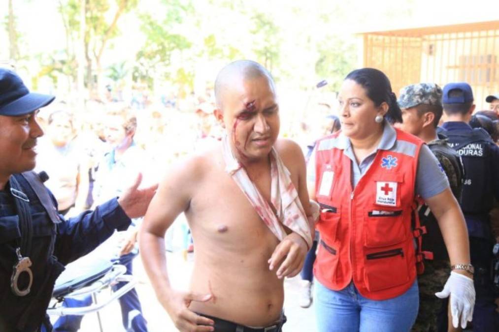 Un total de 33 reclusos heridos fueron atendidos en el hospital Mario Rivas de San Pedro Sula.