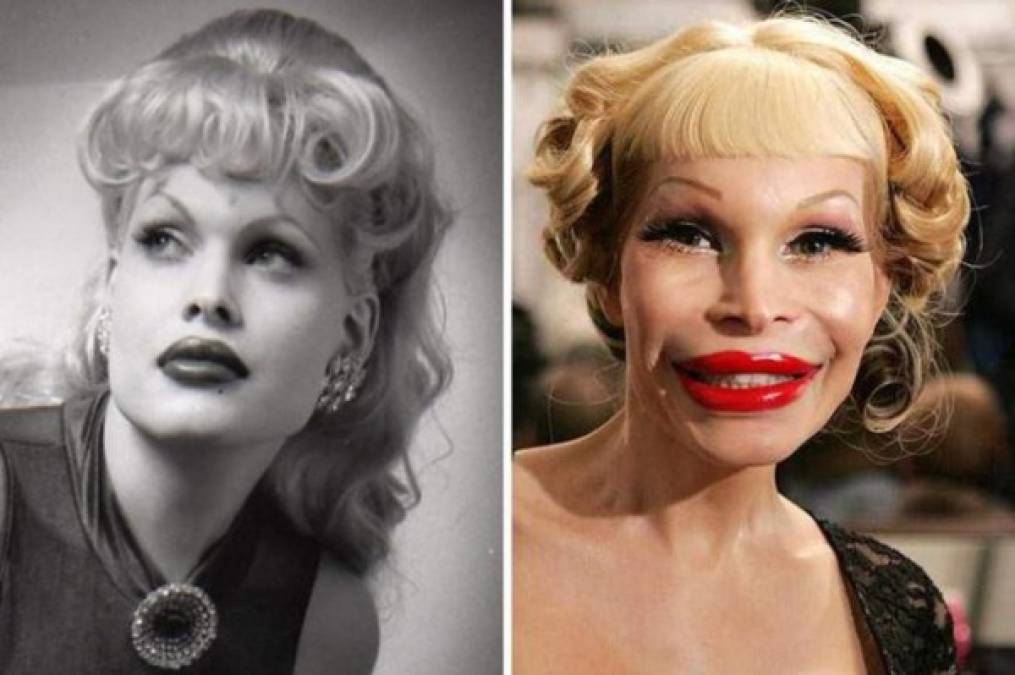 Amanda Lepore: ha sido el rostro de múltiples marcas de moda, además de aparecer en películas y grabar discos. Pero su aspecto se ha ido deformando año a año, con cirugías plásticas que parecen no terminar nunca.<br/><br/><br/>