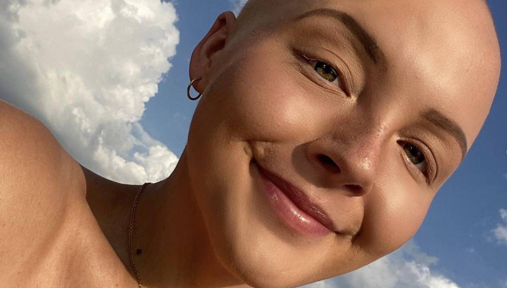 Muere joven tiktoker Maddy Baloy de cáncer en Florida