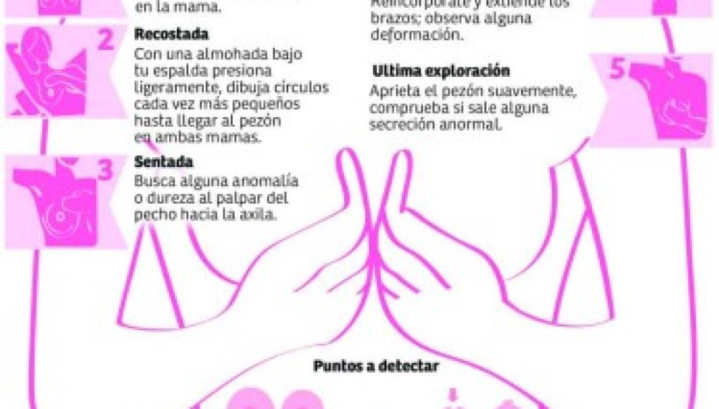 Cáncer de mama: Que no le dé pena, ¡tóquese! Evite ser parte de las estadísticas