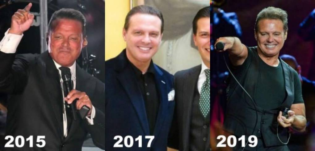 Cirugías. En 2017 Luis Miguel fue motivo de polémica cuando se difundió una fotografía en la que el cantante apareció con un nuevo look, en las fotos el cantante aparecía sin arrugas y mucho más delgado, para algunos era obvio que el 'Sol' se ayudó del bisturí para mejorar su aspecto, el que había decaído entre sus múltiples pleitos legales.