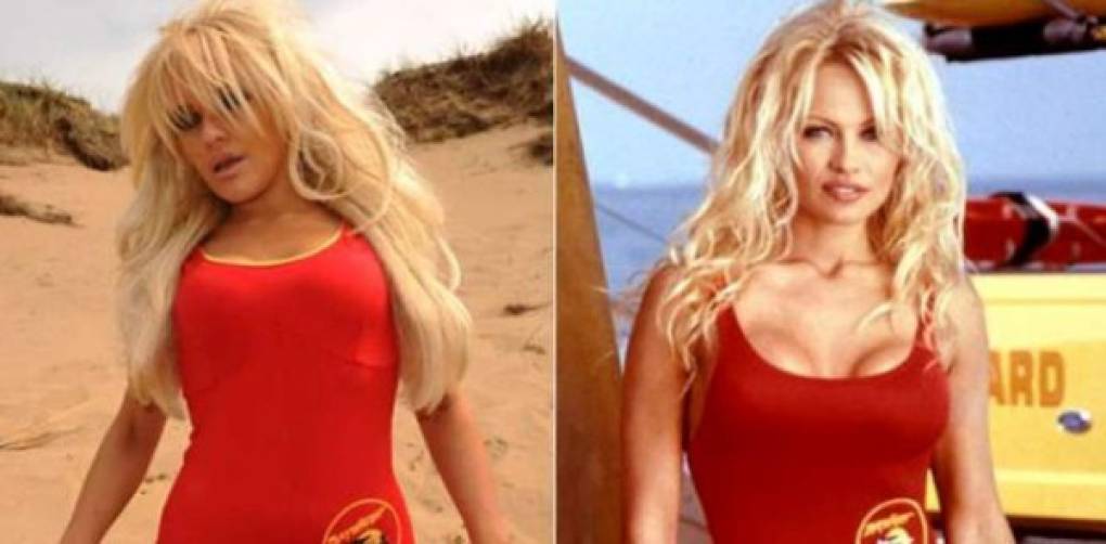 Carolyn Anderson se ha puesto implantes en los senos, se ha inyectado los labios y se ha blanqueado los dientes para ser como la vigilante más famosa de la playa, Pamela Anderson. <br/>