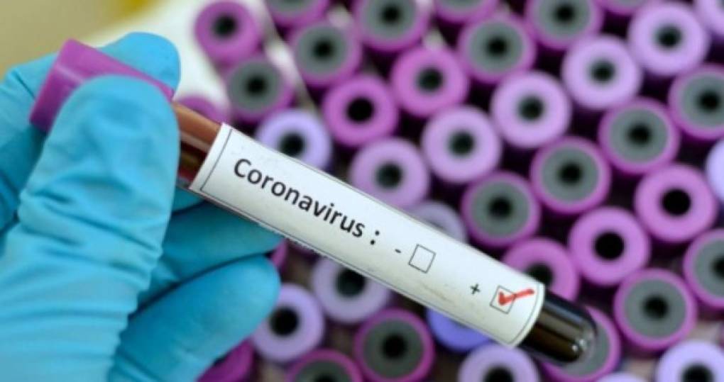 Por su parte la OMS declara al coronavirus como pandemia y advierte que subirán los casos.