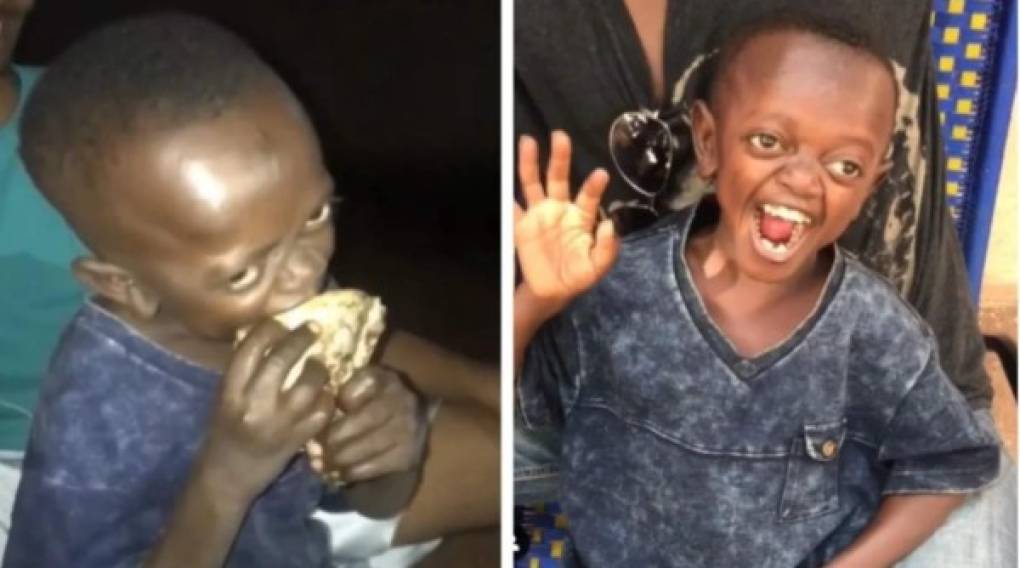 El joven africano sufrió acoso por su condición de enanismo, pero que los videos virales le devolvieron la confianza y el respeto de su gente.