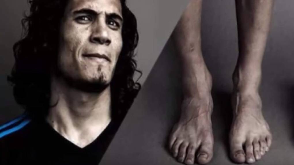 Cavani: El delantero del PSG y de la selección uruguaya tiene unos pies que si bien muchos le envidian por su talento, pero casi nadie por su apariencia.