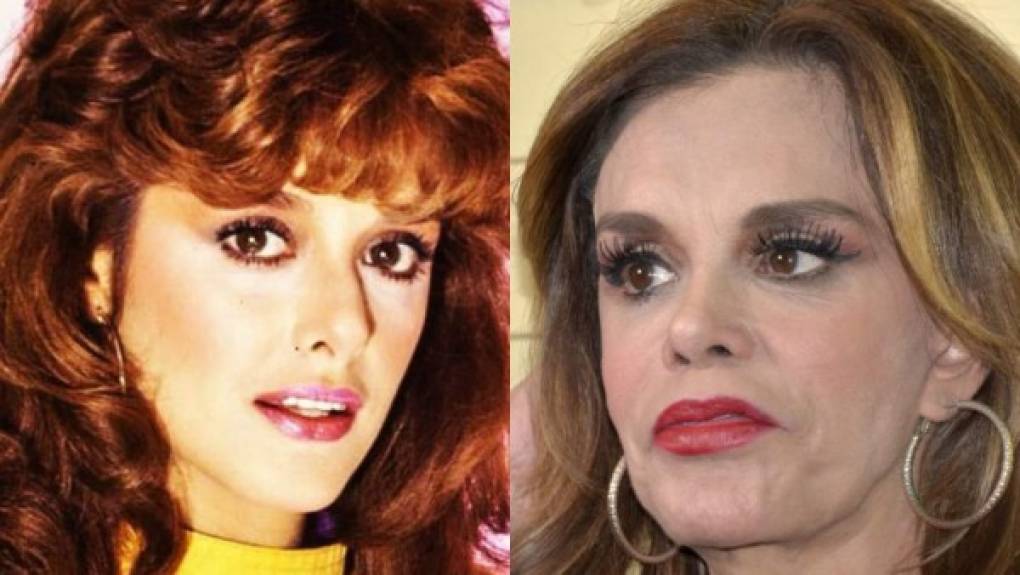 Lucía Méndez tenía uno de los rostros más bellos en los años 80, con el paso del tiempo se sometió a varias cirugías plásticas, de las cuales aseguró en una entrevista que se arrepintió.