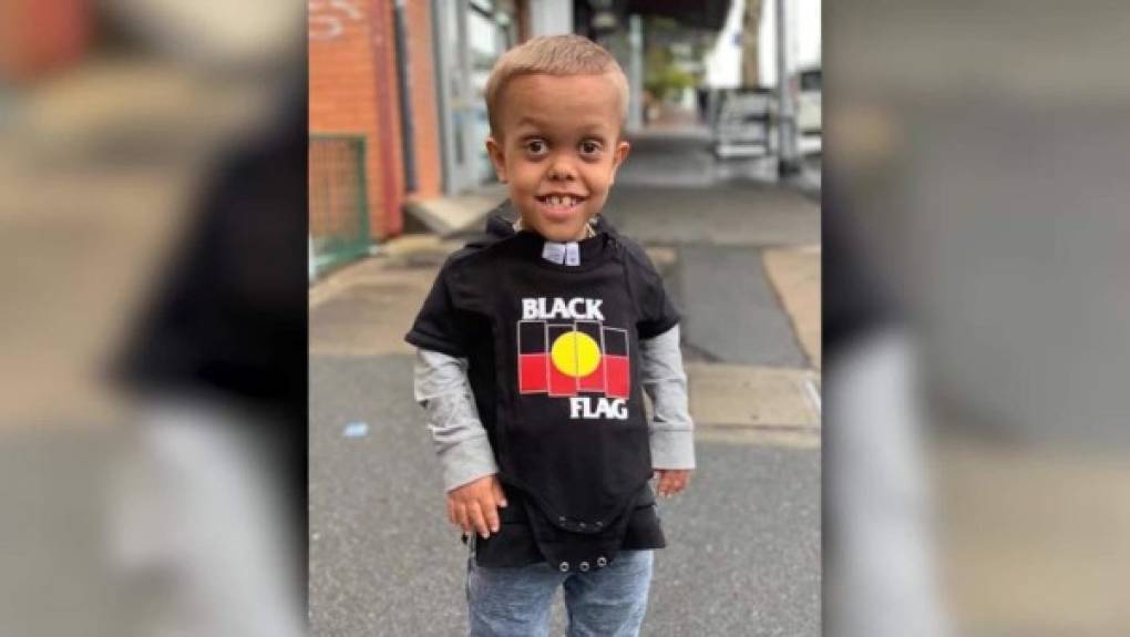En ese sitio, también adjuntan este video de 25 minutos donde el programa australiano “Living Black” documentó en 2015 la historia de Quaden. “Quaden Bayles, de cuatro años, mide solo 65 centímetros, el tamaño de un bebé de 6 meses”, comienza la narración.<br/>