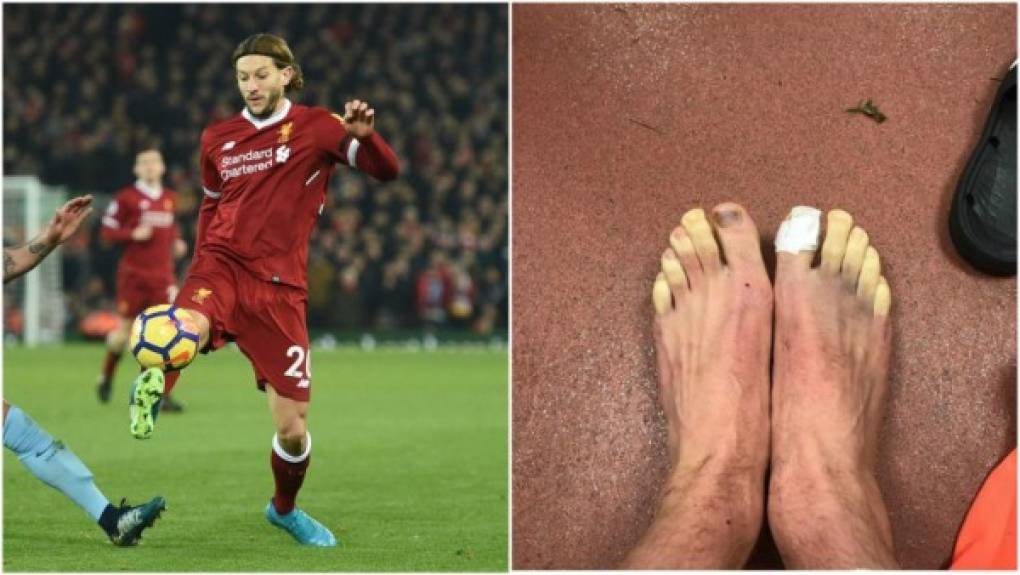 En las últimas horas, el mediocampista Adam Lallana del Liverpool subió a su perfil de Instagram una fotografía tomada en el vestuario en la que muestra el estado en el que se le quedaron los pies congelados tras el encuentro. El jugador incluso pedía ayuda a los aficionados. '¿Alguna sugerencia para descongelar pies?'.