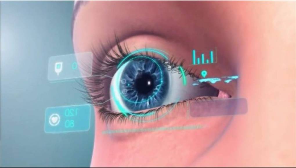 Otras empresas como 'Omega' han diseñado implantes tridimensionales que mantienen una cápsula ocular abierta, este proyecto se llamó Gemini pero fracasó en el intento.
