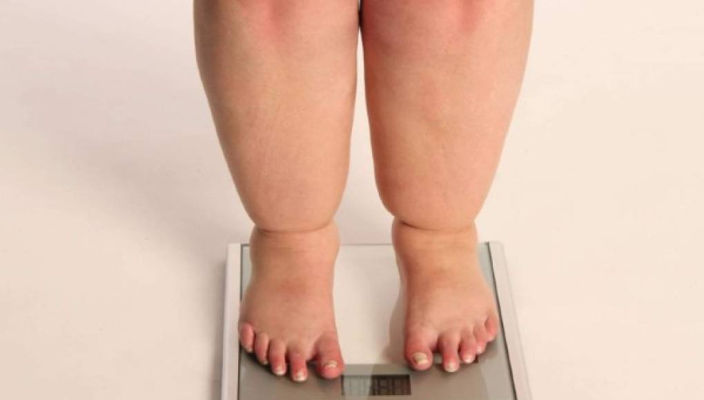 ¿Padecer de sobrepeso puede disminuir la fertilidad?
