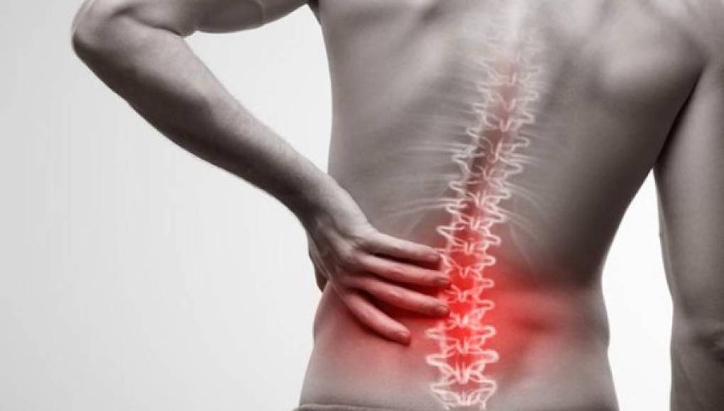 Unos 60 millones de latinoamericanos son afectados por dolor lumbar crónico