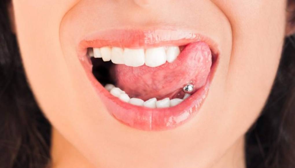 Los piercings en la lengua podría resultar nocivos para los dientes y las encías