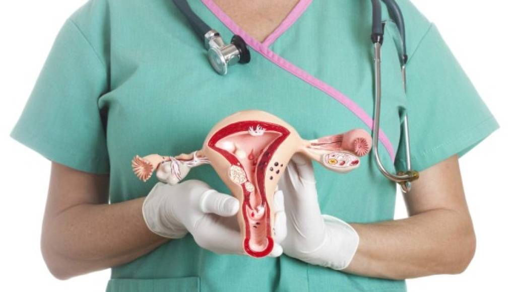 Cinco cosas que debe saber del cáncer uterino