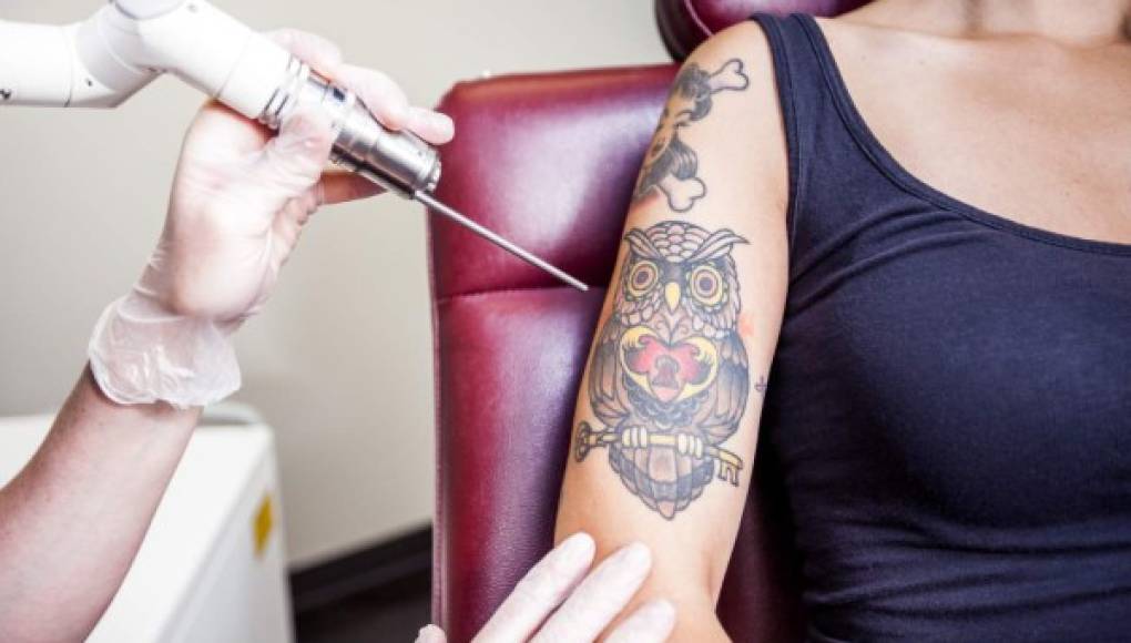 La FDA advierte de los peligros de los tatuajes