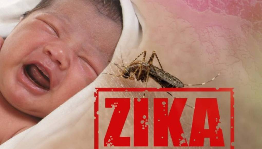 El Zika también puede dañar la vista de los bebés