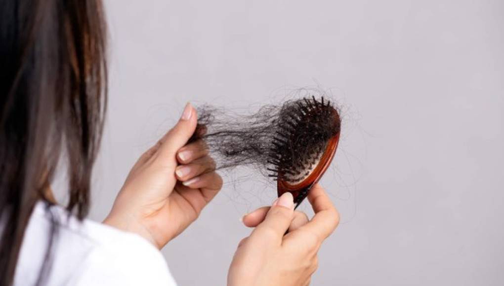 COVID-19: Alopecia areata y efluvio telógeno, nuevos síntomas que lo hacen perder el cabello