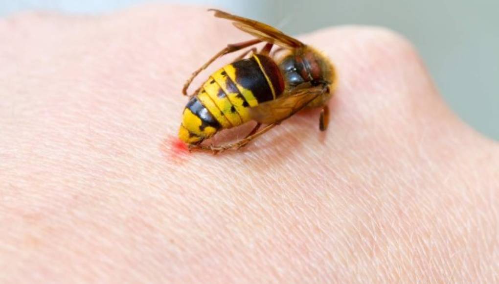La escasez de veneno de abejas y de avispas afecta a las personas con alergias