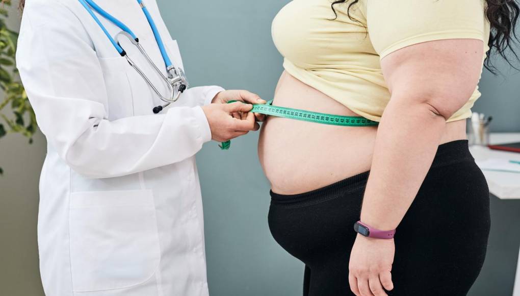 La obesidad acarrea un mayor riesgo de muerte prematura
