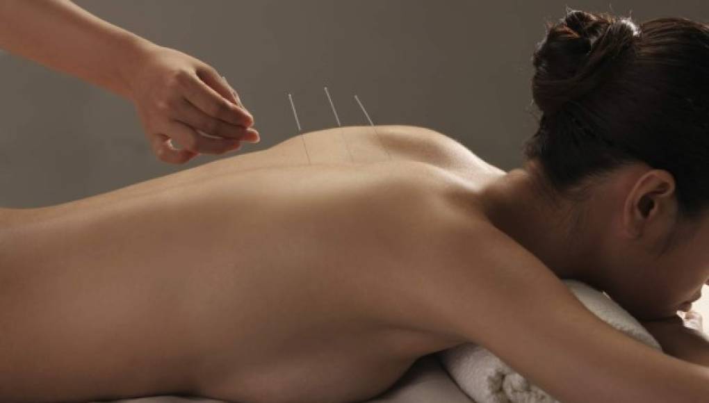 En duda el uso de la acupuntura contra el dolor