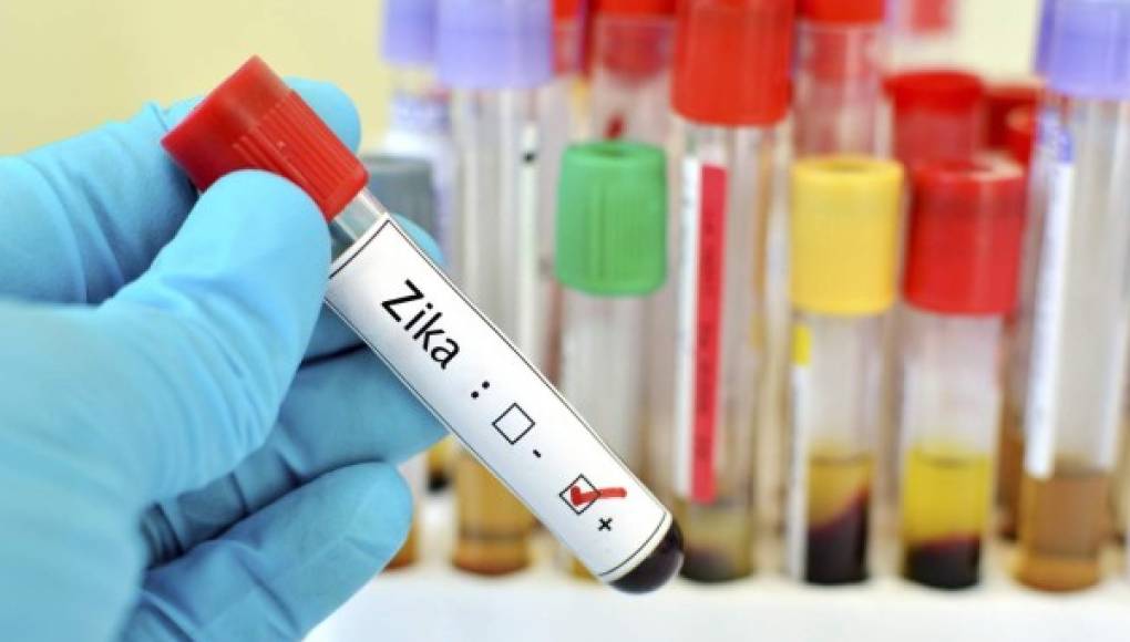 Vinculan al Zika con problemas neurológicos en adultos