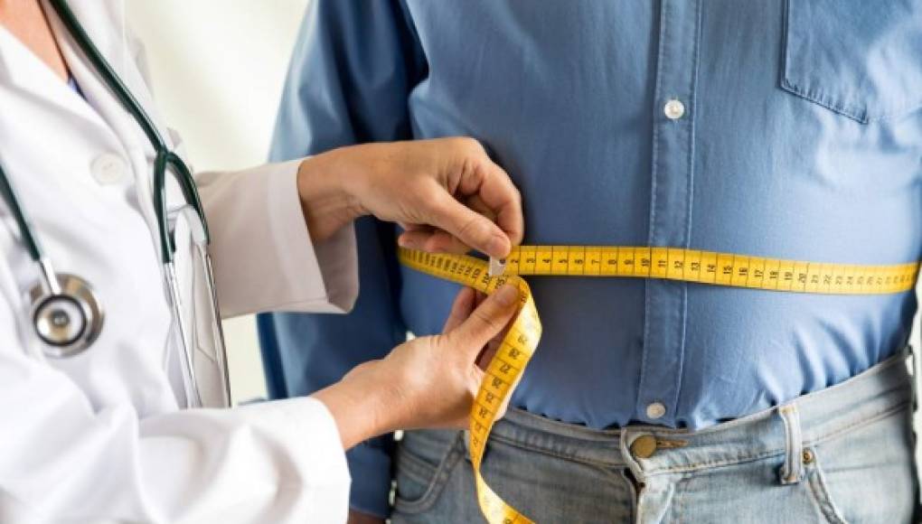 Dieta, estilo de vida y estigma provocan aumento de obesidad en Latinoamérica