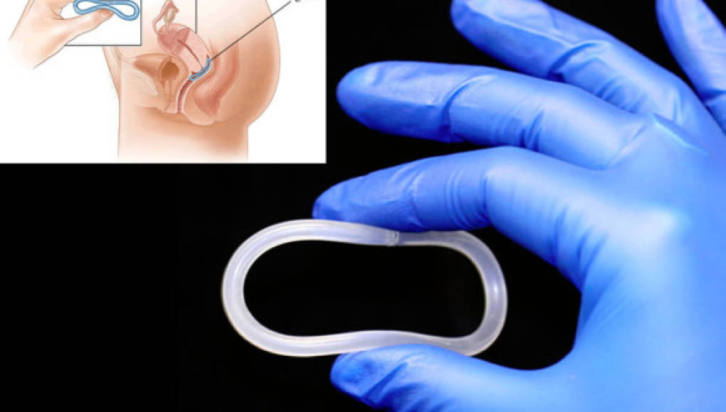 El anillo vaginal que protege del sida