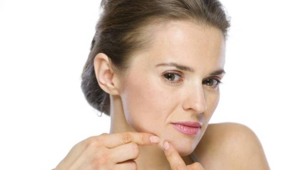 Las mujeres adultas sufren con frecuencia de acné