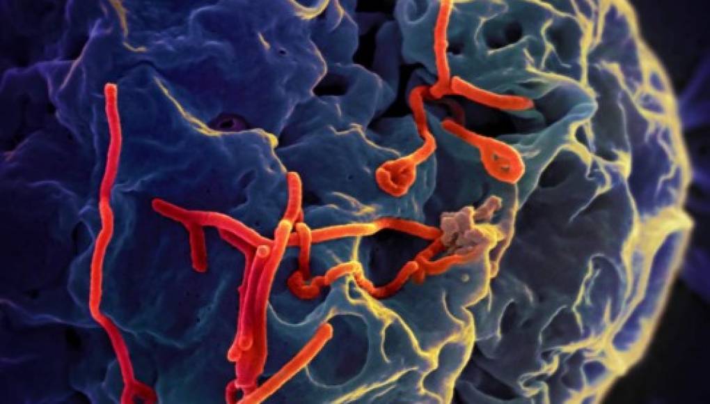 Mutaciones del virus ébola podrían afectar tratamientos