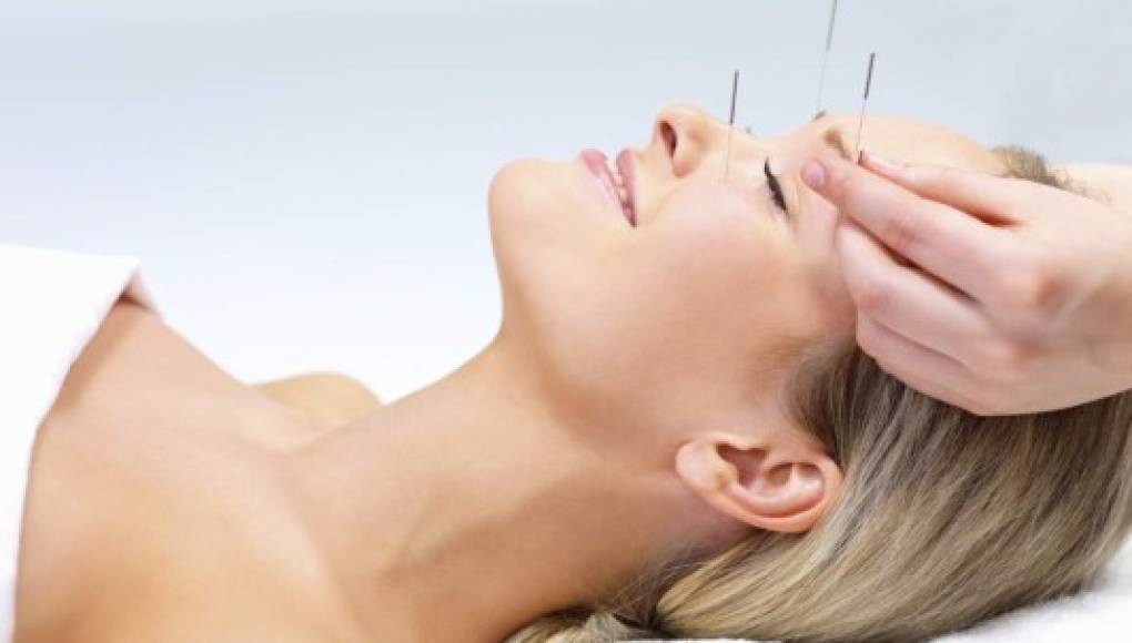 La acupuntura podría ayudar a aliviar la hipertensión