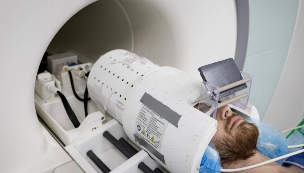 El IRM más potente del mundo muestra increíbles imágenes del cerebro humano