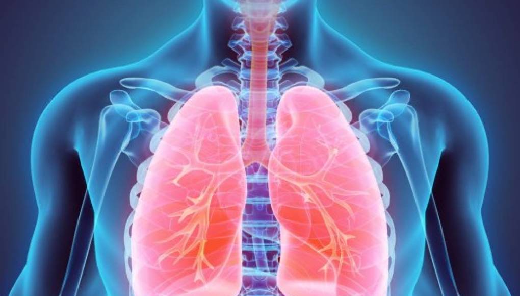 Tabaquismo causa 85 % de los casos de cáncer pulmonar, señala experta