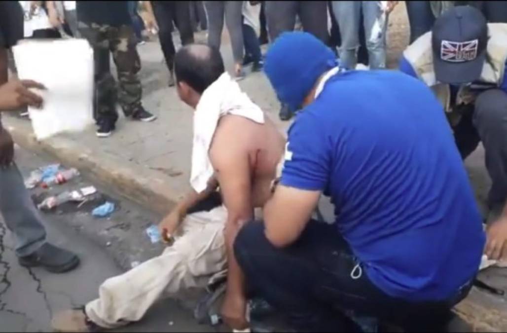 La marcha también fue emboscada por policías motorizados que presuntamente llegaron disparando contra la muchedumbre, que huía despavorida de la masiva concentración.<br/><br/>Voluntarios comenzaron a atender a los heridos en plena calle, mientras otros eran trasladados a hospitales en motos.