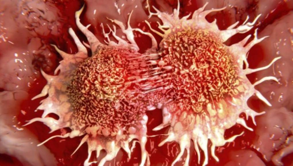 Tratamientos para el cáncer abordados genéticamente son más eficaces