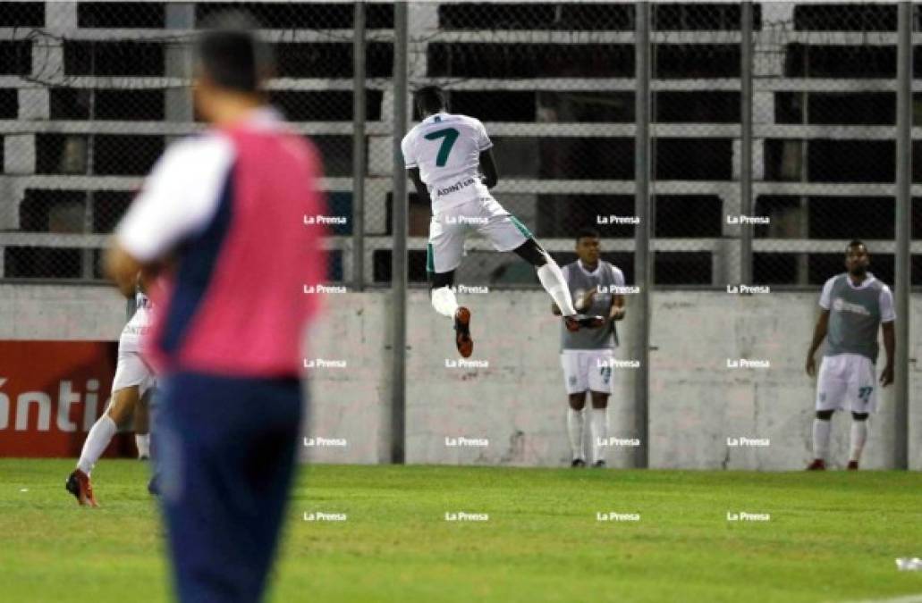 Así celebró Rundell Winchester su gol, a lo Cristiano Ronaldo.