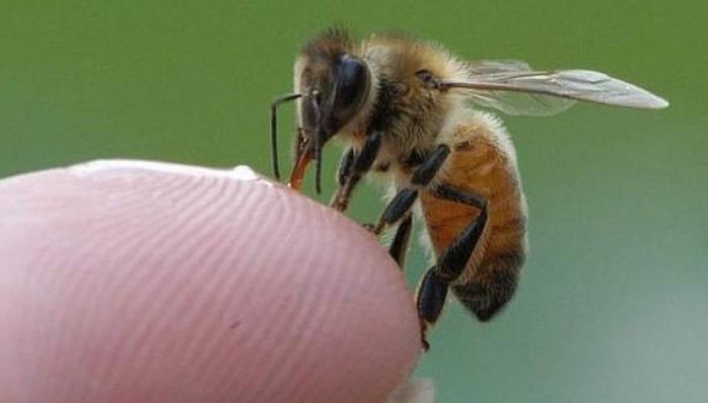¿Debe ir al médico por las picaduras de insectos y abejas?
